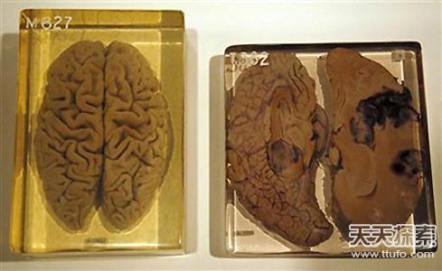 有关大脑怪异事实：盗梦空间真的存在