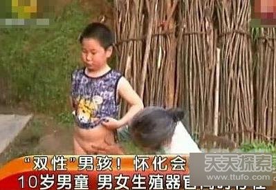 世界十大人体奇闻：埃及美女竟然长了尾巴